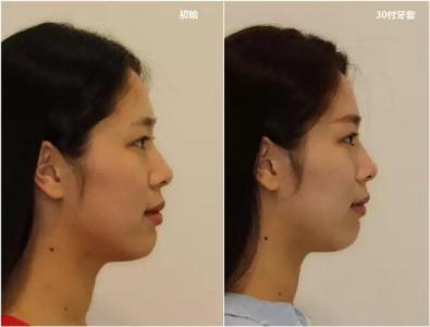 满满的少女感，她却是性感辣妈