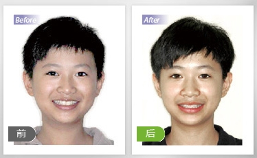 同样的青春 更美的笑脸