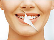 牙齿修复